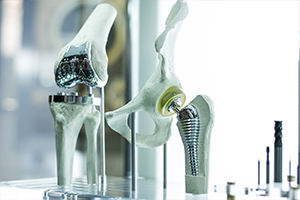 Dispositifs médicaux : Capteurs de pression pour les prothèses orthopédiques